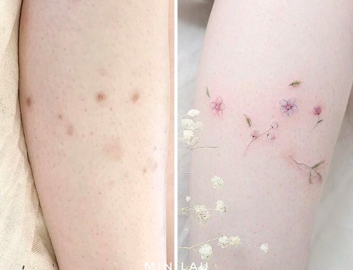 culturainquieta's tweet photo. Ejemplos de cómo convertir nuestras cicatrices en arte con tatuajes: https://t.co/a3xXkD7J1J #culturainquieta https://t.co/yk1yaH7KMo