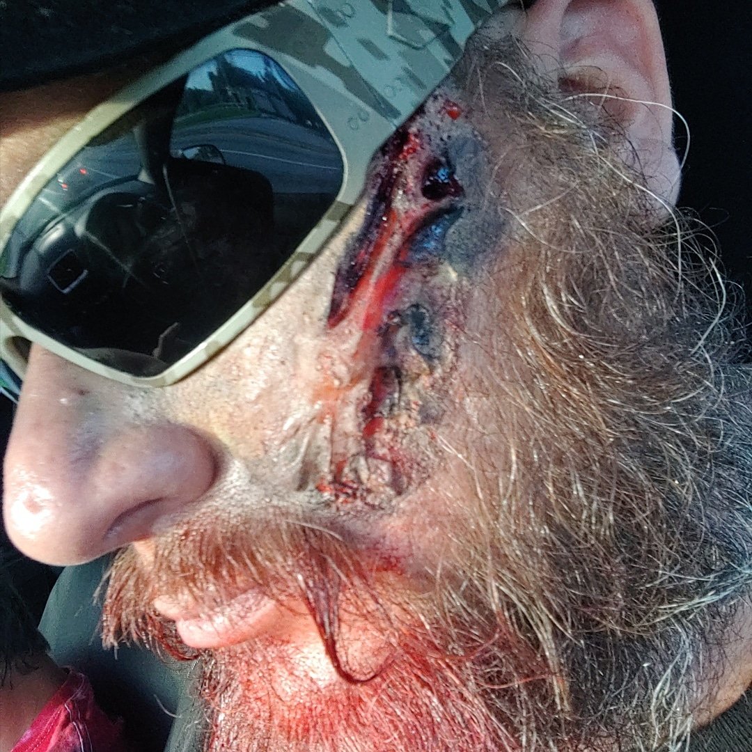 _ChrisApplegate's tweet image. Feeling a little dead
#zombie #Survivaloftheapocalypse