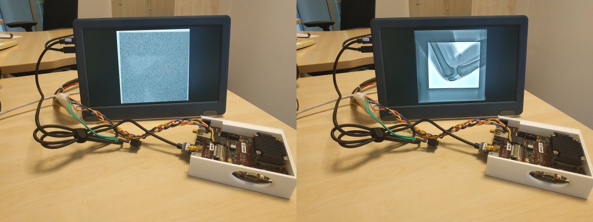 TULIPP_H2020's tweet image. Successful conclusion to EU’s three-year TULIPP project for embedded image processing and vision applications.

tulipp.eu/tulipp-project…

#tulipp #imageprocessing #dsp #energyefficient #xray #noisereduction #ai #machinevision #robotics #robotvision