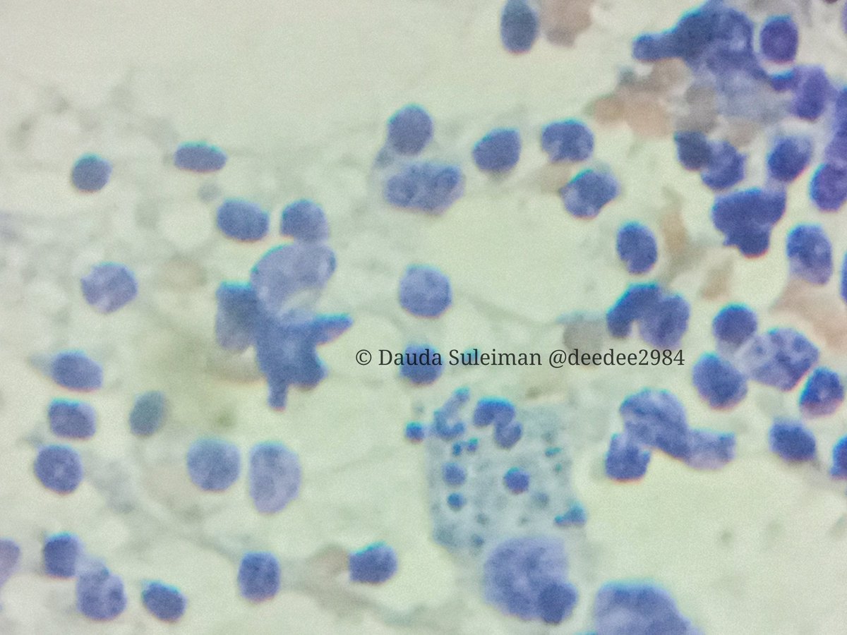 deedee2984's tweet photo. A nice tingible body macrophage to start the work day. #cytopath #LNPath https://t.co/gcGNWu73pr