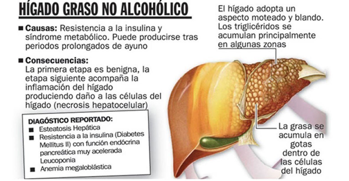 Higado colesterol Higado colesterol