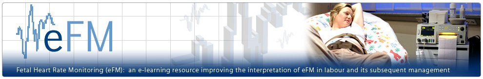 NHSE_TEL's tweet image. eFM includes case studies to practise the interpretation of a fetal heart recording ow.ly/56Lu30p6DVf #HEETEL @RCObsGyn @MidwivesRCM #GroupStrepB #GBSaware
