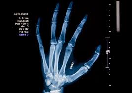 robertpaulreyes's tweet image. #Swedes Are Getting #MicrochipImplants in Their Hands to Replace Cash, Credit Cards! Amen! Swedes to smart to believe in #MarkoftheBeast BS!
Swedes Are Getting Microchip Implants in Their Hands to Replace Cash, Credit Cards! Amen!