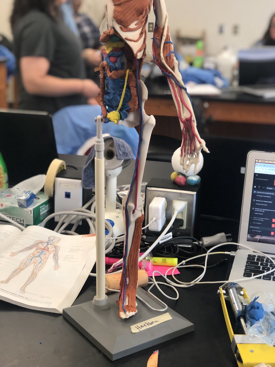 MrsTLLarkin's tweet image. .#larkinHBSkids #jchslife finishing up circulatory system with veins, arteries, use of a fedal Doppler and diagnosing PAD~ #learnthroughprocess YES students ~ your teachers are doing every lab that you will do over the entire year over these 2 weeks... #teachersworkallsummer