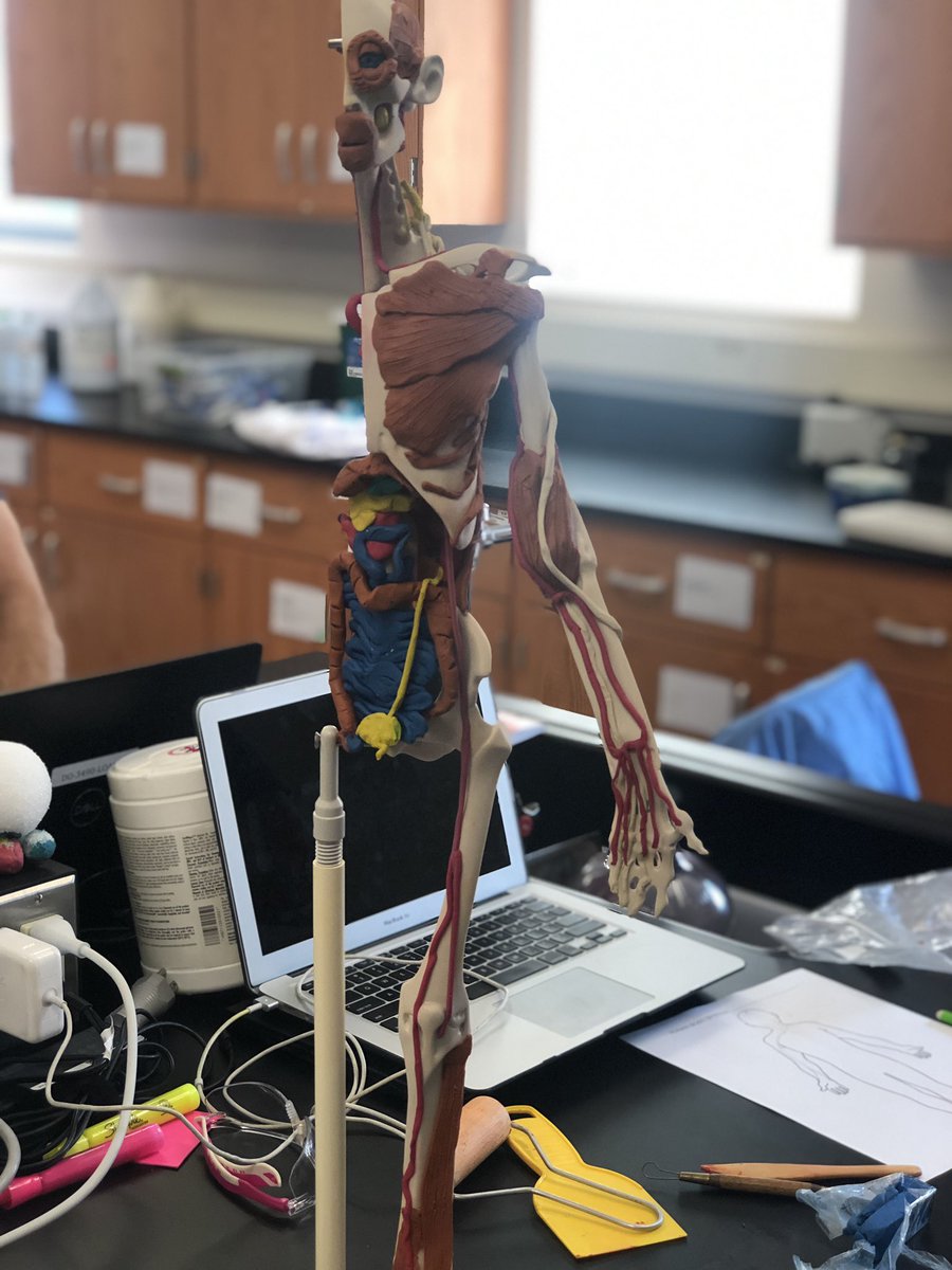 MrsTLLarkin's tweet image. .#larkinHBSkids #jchslife finishing up circulatory system with veins, arteries, use of a fedal Doppler and diagnosing PAD~ #learnthroughprocess YES students ~ your teachers are doing every lab that you will do over the entire year over these 2 weeks... #teachersworkallsummer