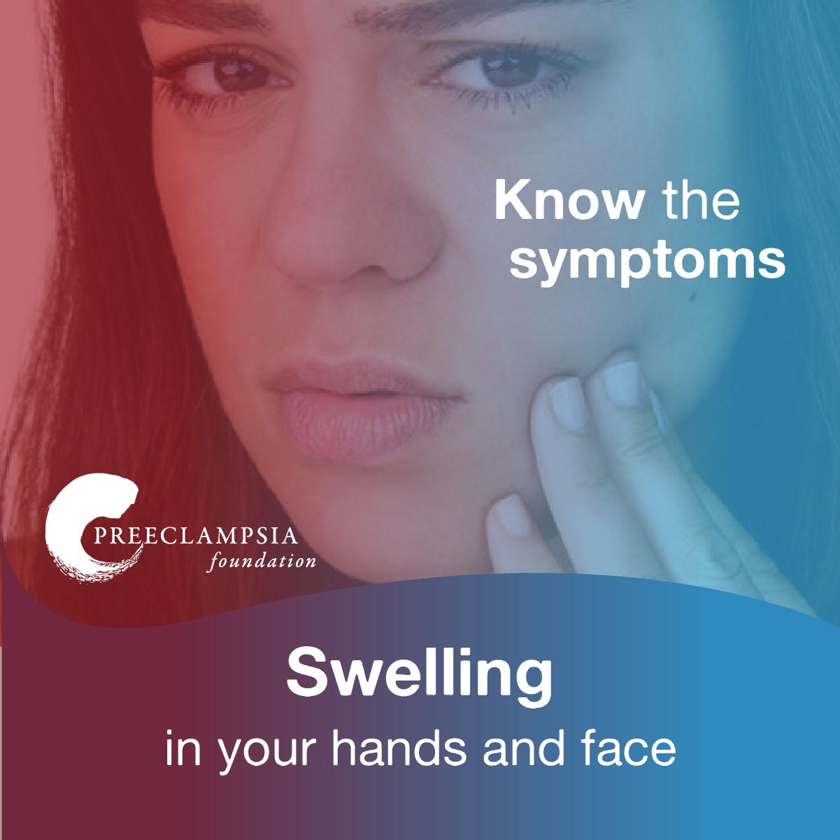 Preeclampsia Facial Swelling