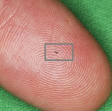 BmfLtd's tweet photo. Drainage Nail for Glaucoma with the resolution of 10μm, is the smallest human body implant device to control the flow and pressure with micro tube shunts or stents. https://t.co/uJMehZrsGp