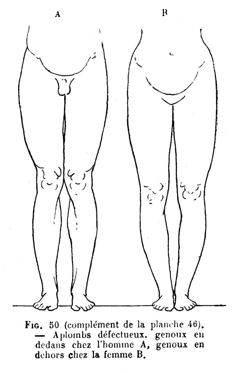 伊豆の美術解剖学者 いわゆる反り腰と猫背 X脚とo脚 これもリシェの美術解剖学書より これらのバリエーションは 造形として意識的に使用できる機会や作例が少ないように思う リシェの教育姿勢は人体の形がまず第一で 使える 使えないという人為的な 伊豆の美術解剖学者 いわゆる反り腰と猫背 X脚とo脚 これもリシェの美術解剖学書より これらのバリエーションは 造形として意識的に使用できる機会や作例が少ないように思う リシェの教育姿勢は人体の形がまず第一で 使える 使えないという人為的な