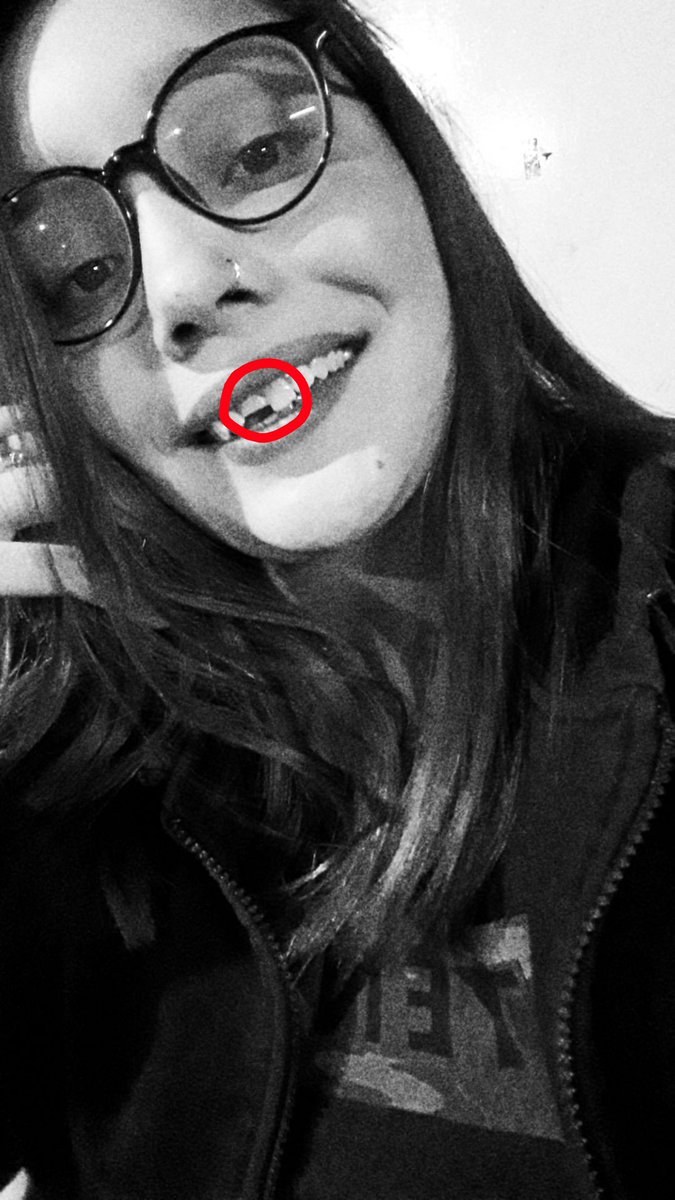 lariguillen1's tweet image. Rt o se te quiebra el diente como a mi 😭