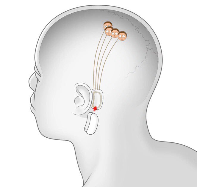 BREAKING NEWS: <a href="/neuralink/">Neuralink</a> released plans to integrate $Mortys into every human brain.

H/T <a href="/kurtybot/">KΞRTY</a> &amp; <a href="/elonmusk/">Elon Musk</a>