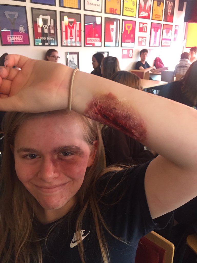 GWKNE1's tweet photo. Awesome day for Team 1 & 2 Northumberland yesterday! We have taken part in a Bite the Ballot session, debating some key social issues. We also completed a First Aid session and finished off with creating our own injuries! Ouch! Go Team!! #ncsnorthumberland #ncsimin https://t.co/Zdg4BbOzWu