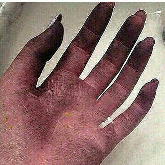 مسكت ركبتي بالغلط🤦🏼‍♀️