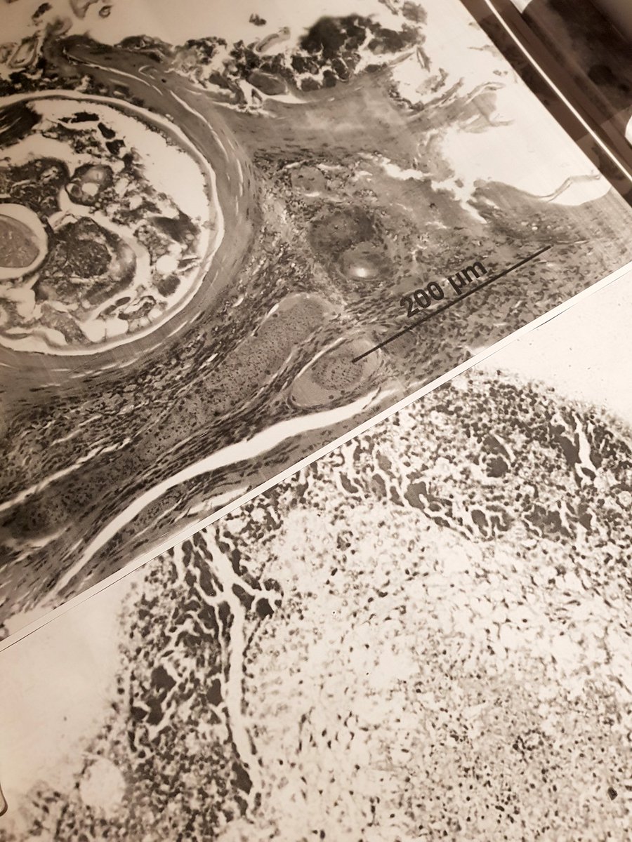 kate_illsley's tweet image. This has got to be the coolest tablecloth! @ArcitectaOnData have printed microscopic images of disease cells &amp;amp; mites as decoration for dinner 🤓
#BigData #LifeScienceData #vict4w #GoGradGirl