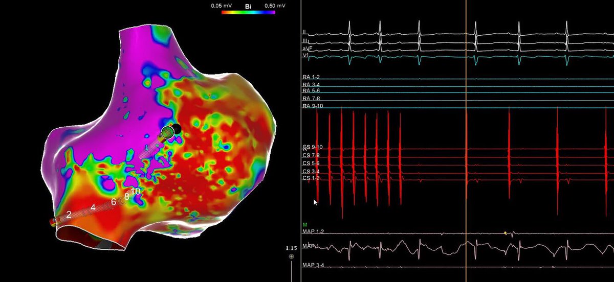 David F. Briceño, MD, FACC, FHRS tweet media