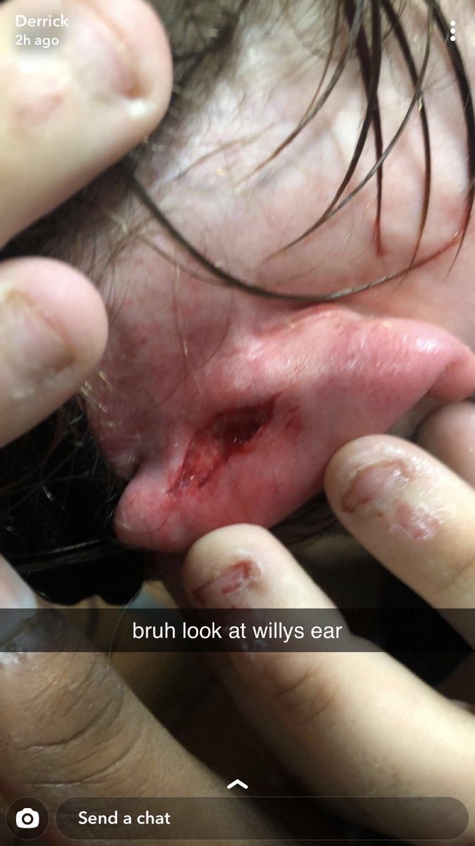 realMCWofficial's tweet photo. MCW is sad to announce that founder and owner Willy “The Boss” McCloskey will be retiring from in-ring competition due to suffering a laceration to the ear. Effective immediately. https://t.co/bsXqtIWscG