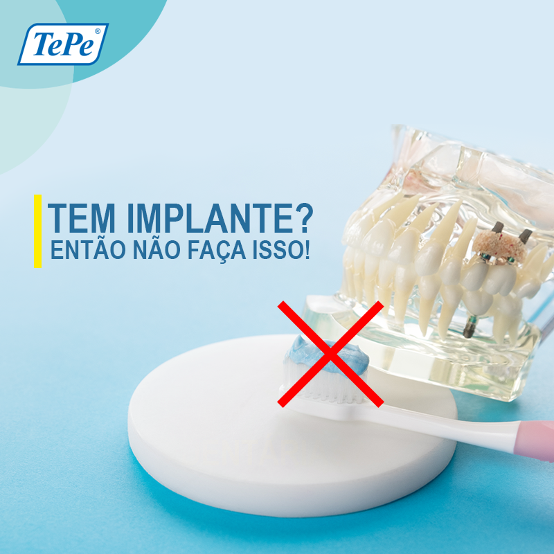 TePeBrasil's tweet photo. Você tem implantes dentários? Então não use uma escova normal!
.
Para a higiene diária é necessária uma escova específica que alcance pequenos espaços e mantenha a higiene
.
Experimente as escovas específicas da TePe! https://t.co/KsQtjmWOHQ
