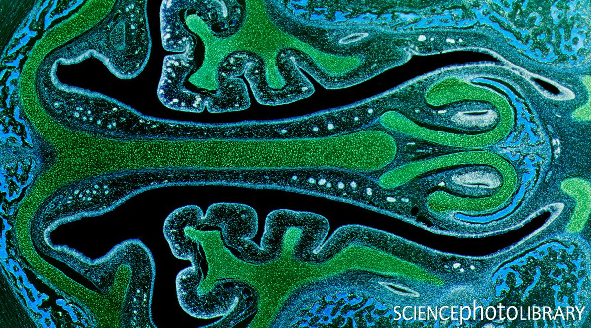 sciencephoto's tweet photo. Bless you! 👃

This Light micrograph shows the nasal sinuses and the supporting cartilages (green). Bone tissue is identified by the blue bone marrow.

C:Steve Gschmeissner/SPL
https://t.co/Jp6mljA48U

 #science #lightmicrograph #biology #nasal #nasalcavity #sinus #anatomy https://t.co/0jI5V1aiu3