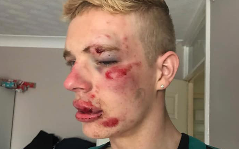 gaytimes's tweet photo. Gay man brutally attacked by homophobes outside McDonald’s.

https://t.co/3k8nWavYVT https://t.co/0KlxafldWQ