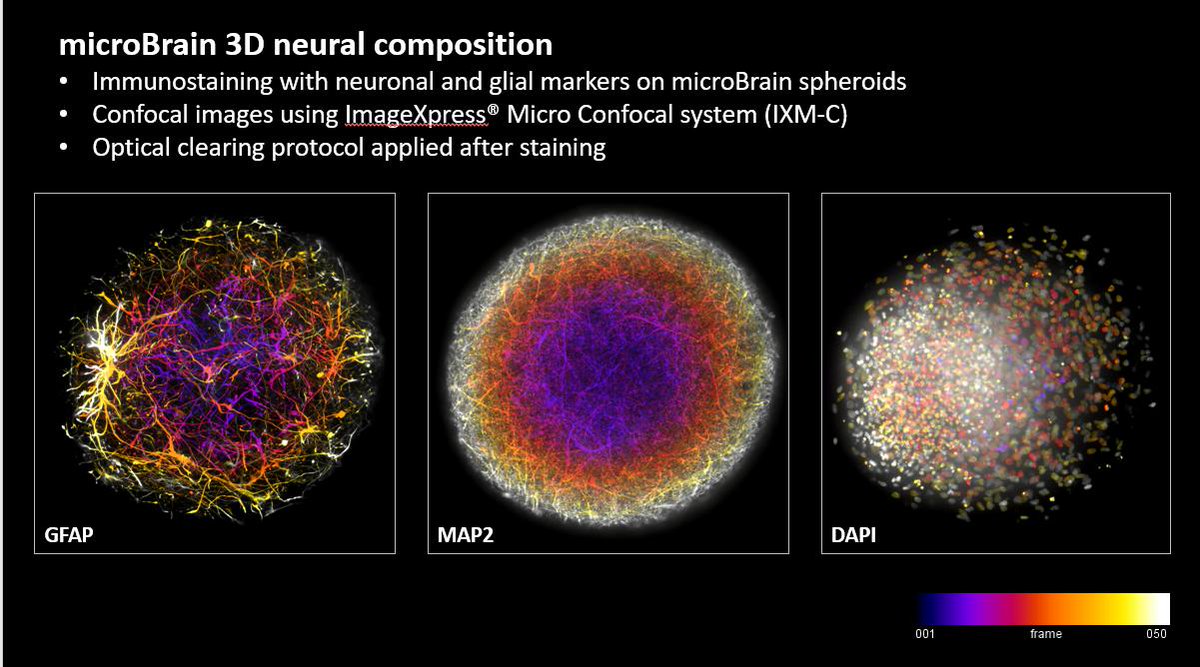 moldev's tweet image. Look at these amazing MicroBrain 3D images from StemoniX using our ImageXpress Confocal System.  #ImageXpress  @StemoniX  #MicroBrain #3D
