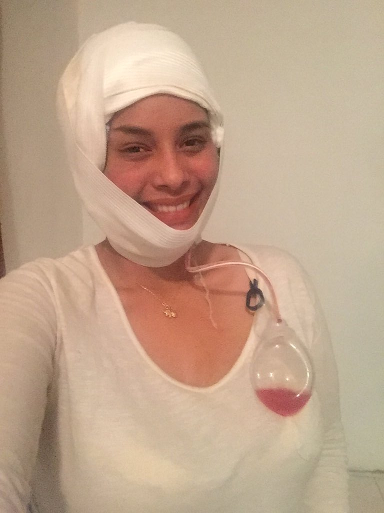 WadskierOriana's tweet photo. ¡Aquí voy, recuperándome poco a poco, pero siempre insistiendo y sonriendo porque los leo y los quiero!♥️😍

P. D. ¡Por favor ayúdenme a lograrlo!¡Apoya mi campaña! Siempre de la mano de Dios y de la mano de ustedes. Un RT ¿Sí? 🙏🏽🙏🏽♥️https://t.co/MmgCnSifRQ https://t.co/KHsc6N0YN7