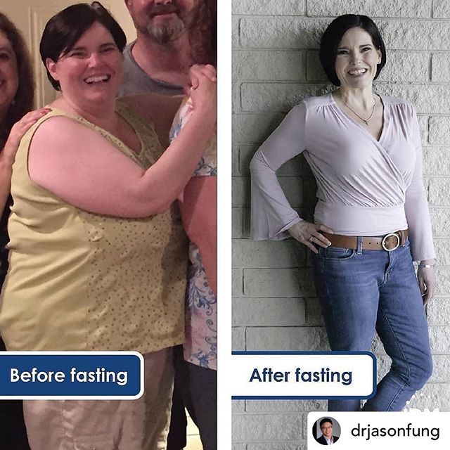Christine Trimpe (@ketochristinemi) on Twitter photo I can’t even! I’ve been away from social media all day and return to this! <a href="/drjasonfung/">Dr. Jason Fung</a> is THE doctor that changed my health completely simply because he shared his amazing health protocols so freely with the world. He CARES about people reversing their … ift.tt/2JPdqvz I can’t even! I’ve been away from social media all day and return to this! <a href="/drjasonfung/">Dr. Jason Fung</a> is THE doctor that changed my health completely simply because he shared his amazing health protocols so freely with the world. He CARES about people reversing their … ift.tt/2JPdqvz