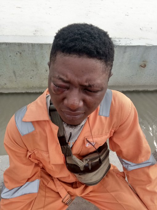Man left with swollen eye after being assaulted by soldier at Dangote Fertilizer Plant in Lekki (photos)