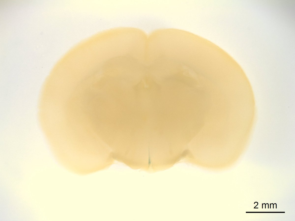 GeneOfTheDay's tweet photo. Todayโs #GeneOfTheDay is #Mat2a. Human diseases associated with this gene include Familial Thoracic Aortic Aneurysm And Aortic Dissection. Mice with this gene inactivated exhibit decreased prepulse inhibition and increased startle reflex: https://t.co/jPB10bgiWX https://t.co/QSkLDYDOGF