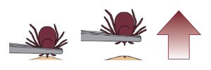 HPPublicHealth's tweet photo. Bitten by a tick? Don’t panic. Learn how to remove it here: https://t.co/kjt2cBzXyT If possible, save the tick in a bag or pill bottle, and bring it in to the Health Unit for testing #LymeDisease #ticks https://t.co/Xs5hXyR17I