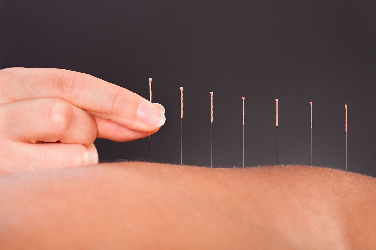 CI4TCM's tweet image. Aches and pains? Feeling under the weather? Why not try #acupuncture? At our Chinese Medicine Clinic we offer acupuncture and a range of other treatment types. To find out more visit the link below

lsbu-confucius.london/clinic/

#southwark #southbank #Wellbeing  @LSBU