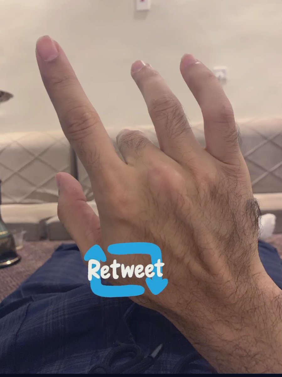 iwail91's tweet photo. خلونا نحسمها https://t.co/ZoX1kJbsgY