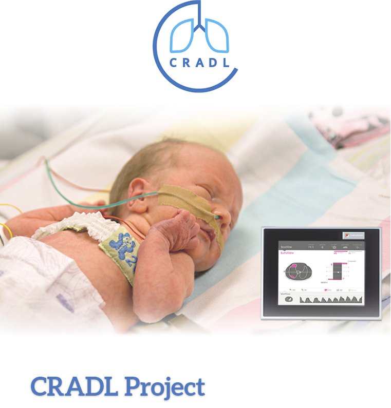 swisstomography's tweet photo. Watch the newest video about regional lung function monitoring in neonates.
 @EU_H2020  @UCL @SchweizerMedtec #patientmonitoring 

https://t.co/WlZeeTvUcw https://t.co/th3RXE6vFD