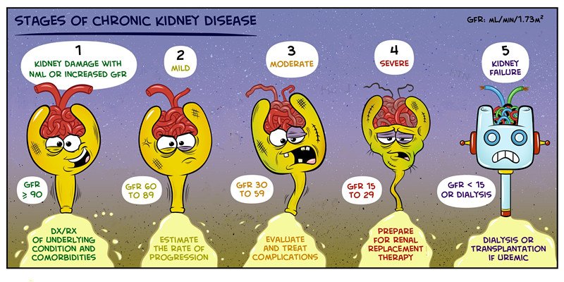 The following picture shows Stages of Chronic Kidney Disease. By observing it, you can know how severely your glomeruli are damaged. Which stage of CKD are you in?