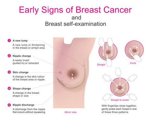 WorldHealthEdu's tweet photo. breast cancer symptoms and signs https://t.co/NQLt5yVsxN https://t.co/F5hQZdIVmt