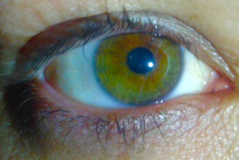 punchablejudy's tweet photo. Strong eyes and good vision release the potential of people to learn, work & lead fulfilled productive lives. Share this message with your own #SelfEye and help us call on governments across #ourCommonwealth to bring #visionforall! #EndTrachoma #CHOGM2018 https://t.co/dctQ23y3R4 https://t.co/DYCDLOm0wE