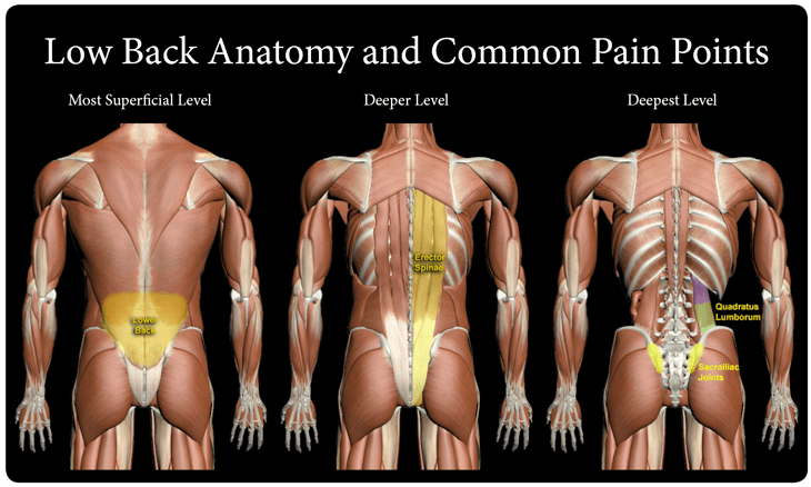 WorldHealthEdu's tweet photo. The Sprains and strains or as commonly known as the Lower Back Pain https://t.co/KsAhFnyBC5 https://t.co/mD8DAQNUmp