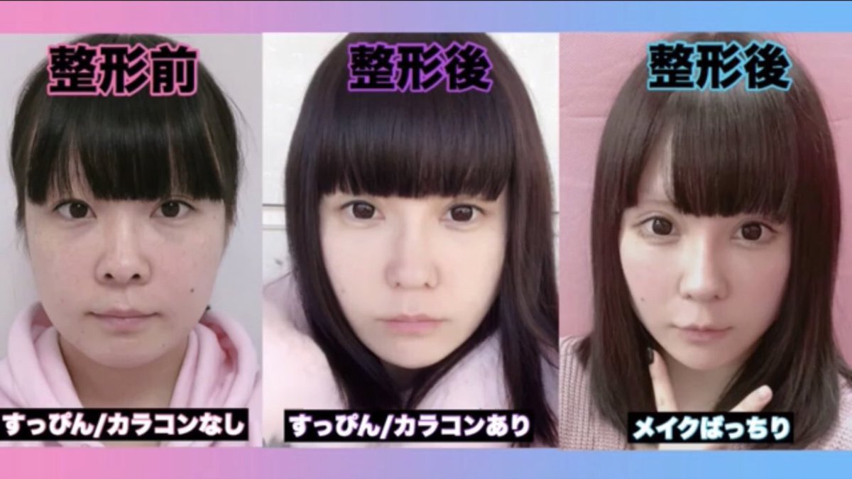 せななん 健康 Twitterissa というわけでっ 4月21日 Yabamiradio Abematv で22 00 放送 私は 整形について赤裸々に語ります ぜひ聴いてくださいっ 出演 渡辺直美 スパイク Guest 有村藍里 せななん T Co Rqkh0rbw0m T Co Mltz9efwt0 せななん 健康 Twitterissa というわけでっ 4月21日 Yabamiradio Abematv で22 00 放送 私は 整形について赤裸々に語ります ぜひ聴いてくださいっ 出演 渡辺直美 スパイク Guest 有村藍里 せななん T Co Rqkh0rbw0m T Co Mltz9efwt0