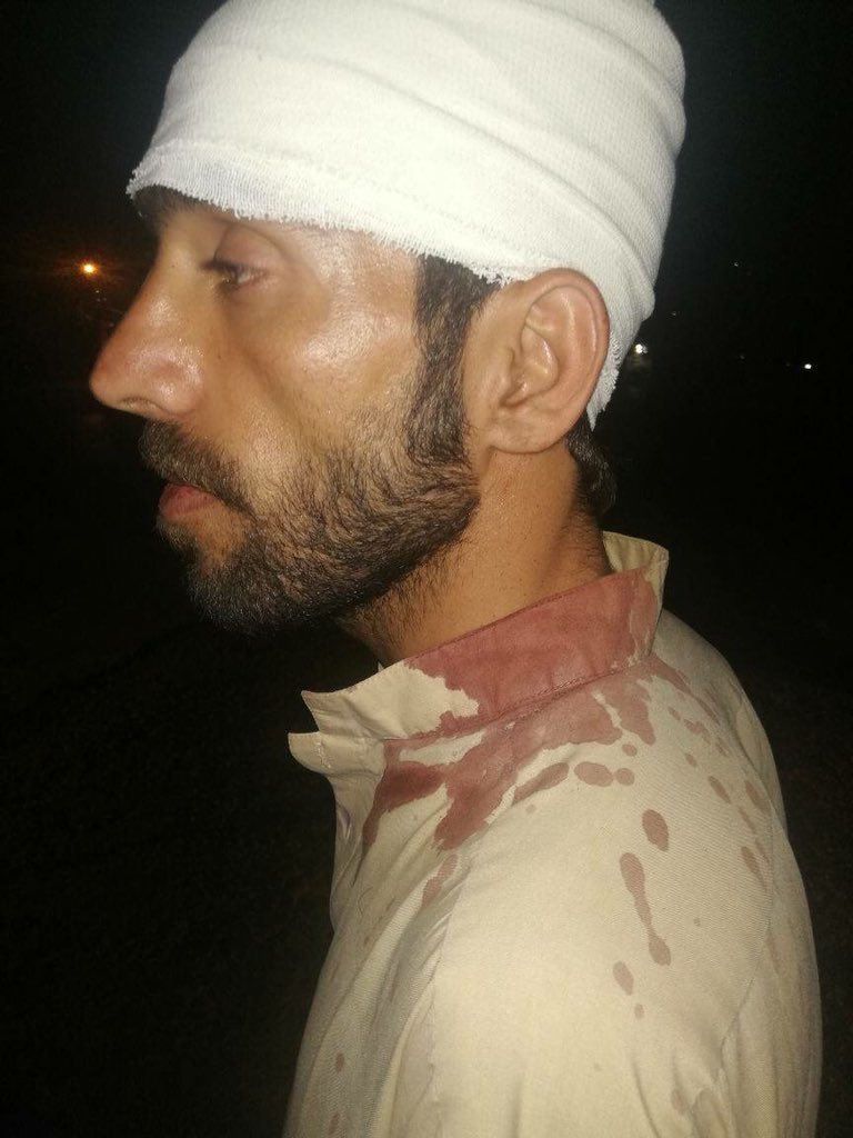 AbabgarBaloch's tweet photo. ملتان میں MSF گروپ سے تعلق رکھنے والے مشہور زمانہ مجرم جو کچھ دن پہلے جیل سے رہا ہوا ہے “کاشی خان “ اور اس کے ساتھ غنڈوں نے بلوچستان سے تعلق رکھنے والے طالب علموں پر حملہ حکومت فوری طور پرنوٹس لے کر ملزمان کے خلاف کاروائی کرے۔تمام تعلیم دوست قوتیں اس واقع کے خلاف آواز بلند کریں ۔ https://t.co/RonLXYWan8