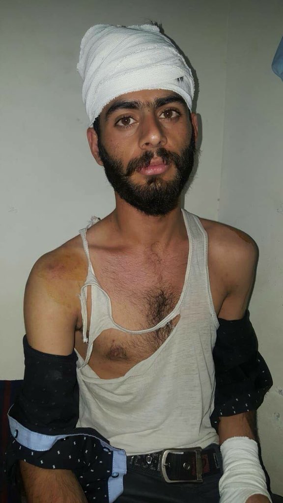 AbabgarBaloch's tweet photo. ملتان میں MSF گروپ سے تعلق رکھنے والے مشہور زمانہ مجرم جو کچھ دن پہلے جیل سے رہا ہوا ہے “کاشی خان “ اور اس کے ساتھ غنڈوں نے بلوچستان سے تعلق رکھنے والے طالب علموں پر حملہ حکومت فوری طور پرنوٹس لے کر ملزمان کے خلاف کاروائی کرے۔تمام تعلیم دوست قوتیں اس واقع کے خلاف آواز بلند کریں ۔ https://t.co/RonLXYWan8