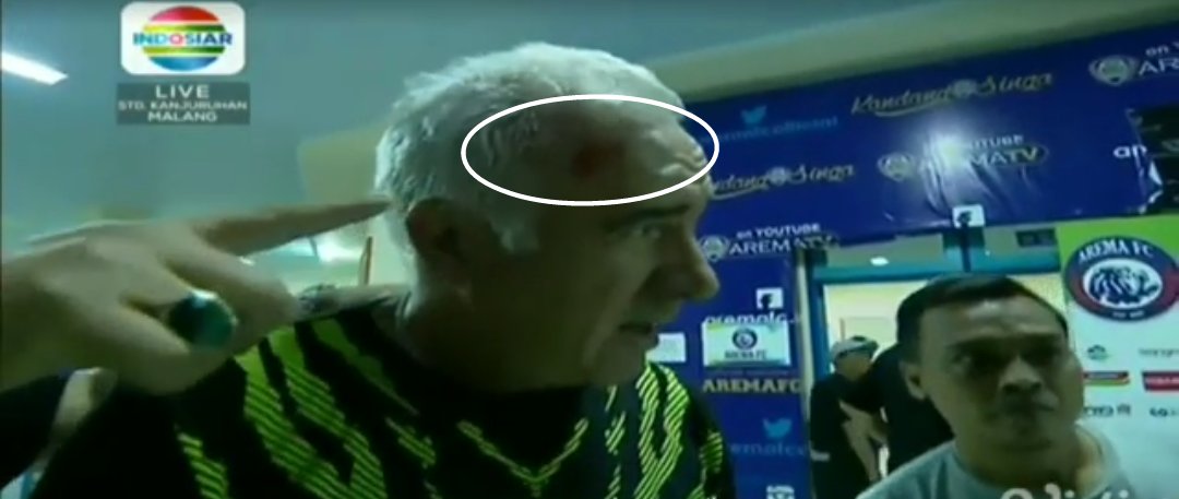 Coach Mario Gomez berdarah...  #PersibDay