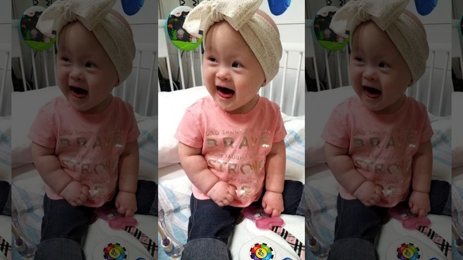 TuhafAmaGercek's tweet photo. Down sendromlu bu yavrunun ismi Grace Rosian. 17 aylık olan Grace 2 ay erken, yani prematüre doğdu ve 2 defa kansere yakalandı. Grace, 8 boyunca kemoterapi gördü, mücadeleyi bırakmadı ve kanseri 2 kez yendi. https://t.co/JYwKsMXlyA