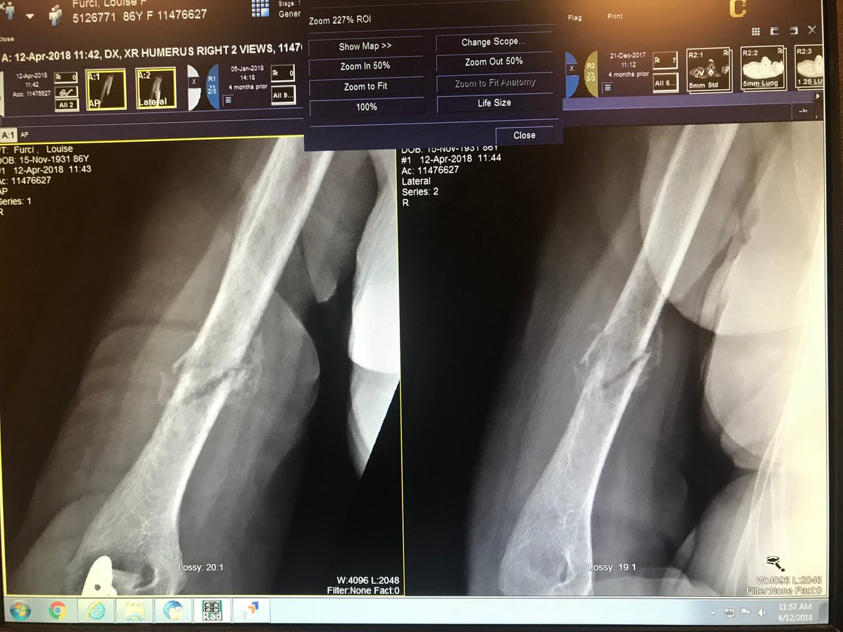 Briellef123's tweet photo. Just posted my week 9 #WISEJournal about another day in an orthopedic surgeon's office! @ChesserPink https://t.co/aFAoqL9vAv