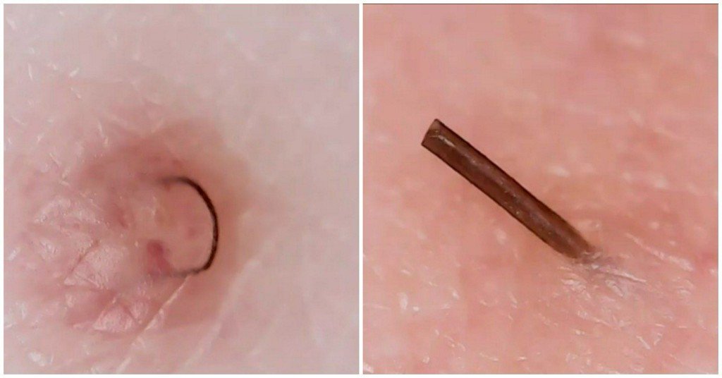 Teen Vogue On Twitter If You Love Dr Pimple Popper Check Out