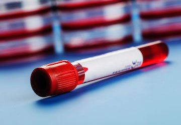 LetsFaceItCare's tweet photo. "#ClevelandClinic's #GroundbreakingStudy: #BloodTest For #EarlyCancerDetection"
https://t.co/uLV3h1f8nb
#LatestHealthCareNews https://t.co/fICpPOTpZJ
