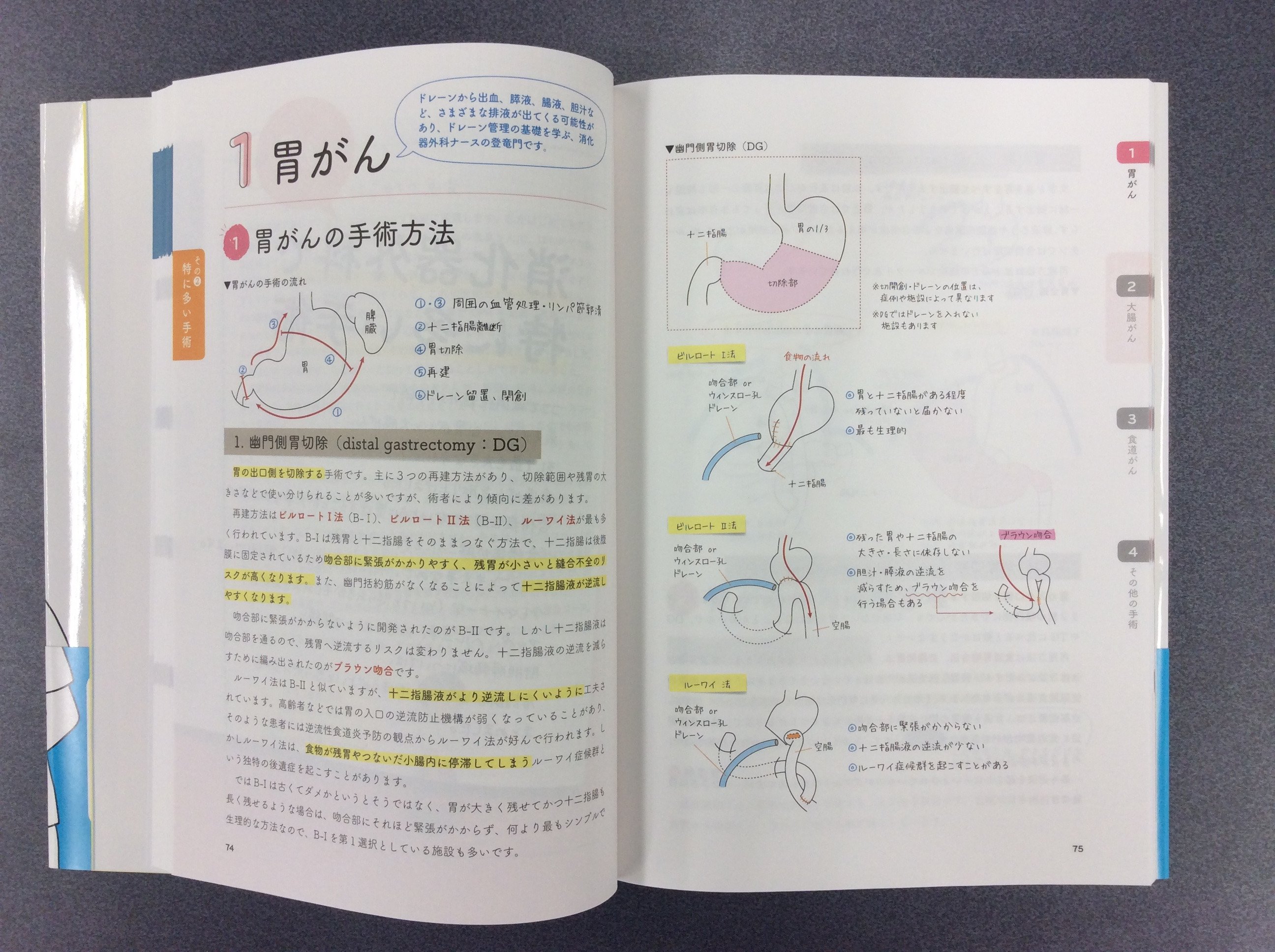 海外お取寄せ商 先輩ナースが書いた消化器外科ノート E 新特別価格版 Cfscr Com