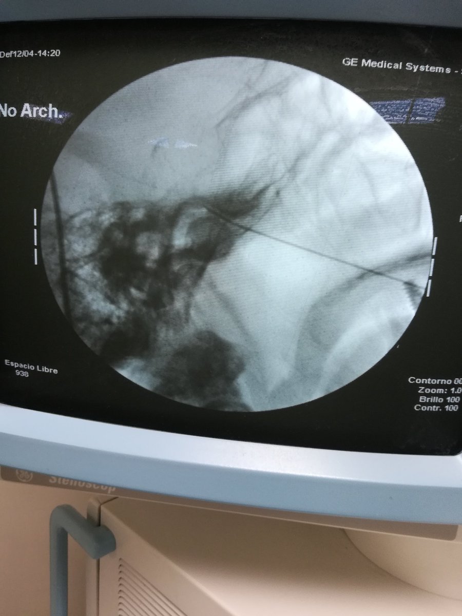 najeraymedellin's tweet image. #NeuralgiaDelTrigémino #SanLuisPotosí #SLP #LagosDeMoreno #QRO #ViveSinDolor #RíoVerde #CuidadosPaliativos