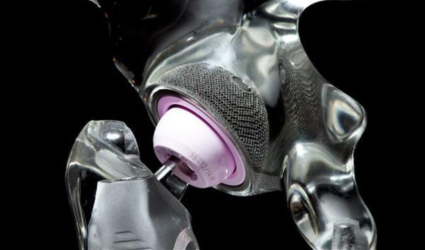 A3D_Project's tweet photo. 10 ans plus tard, la première hanche imprimée en #3D reste solide https://t.co/N3HRfsesJj #3dprint https://t.co/4ziOLSbEMG