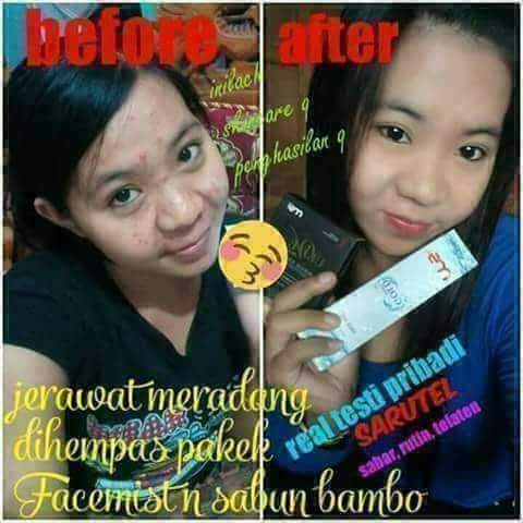 Maaf ya q sambil promo
Siapa tau aja sahabat MLF ada yg minat kan...
#FildanDiLIDATop10