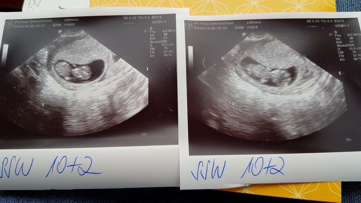 Fette news! Ab Anfang Juni bin ich zurück! Ich Streame wieder. Und zwar solange bis die 2 da auf dem Bild beschließen das Licht der Welt zu erblicken! Ich freue mich auf euch 😊