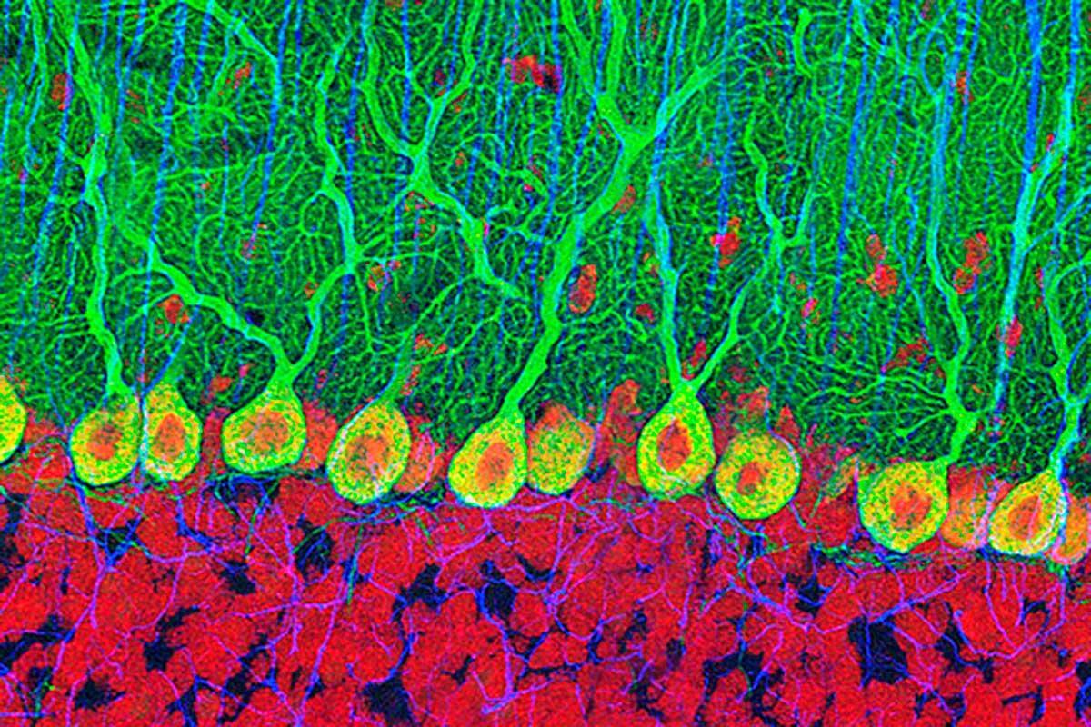 Old people can produce as many new brain cells as teenagers bit.ly/2HBs5ZQ