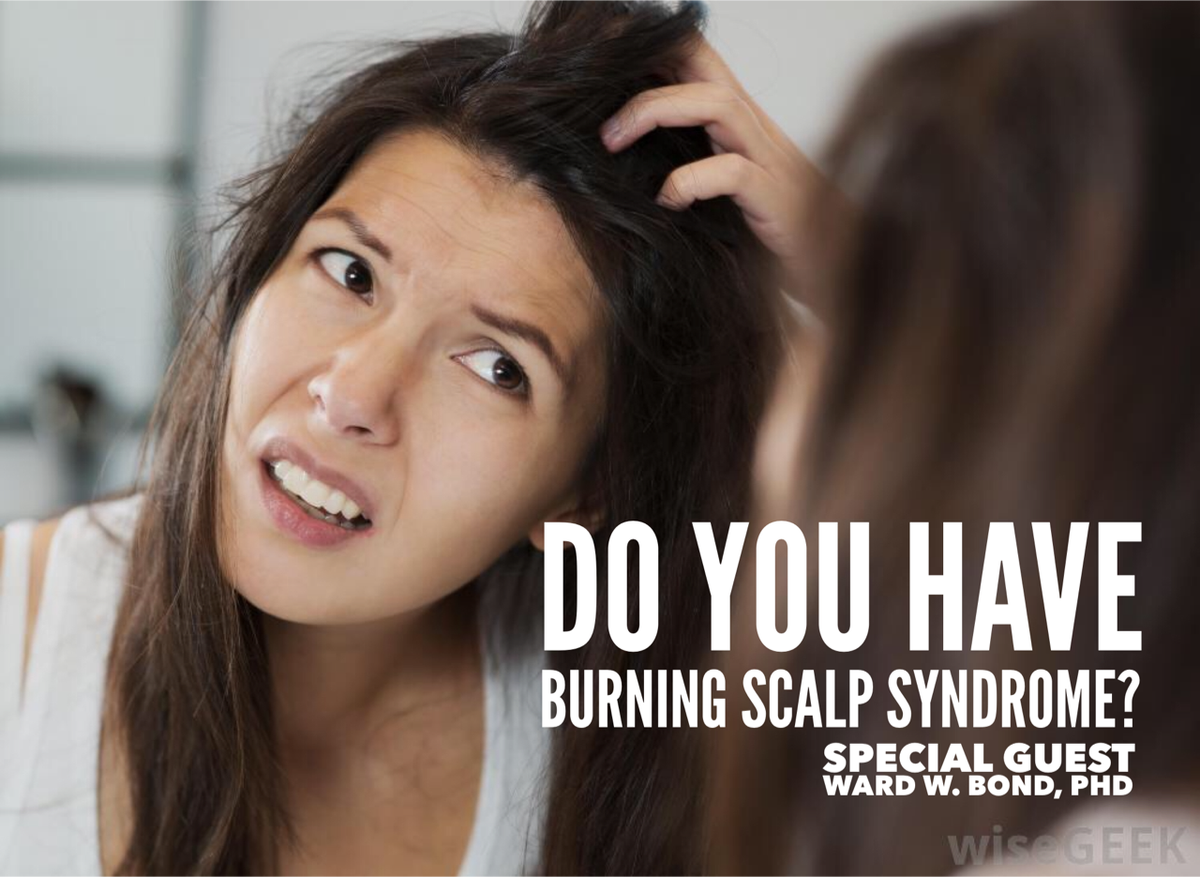 DrWardBondTV's tweet photo. Burning Scalp Syndrome: Substance P & Pain https://t.co/Vr8kXFrZ5c #LifeChangingWellness #burningscalp #scalpproblems #haircare #hairloss #stress https://t.co/zRAe7tsvnK